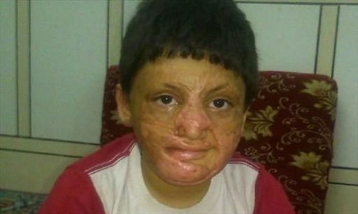 استمداد از مسئولان خوزستانی؛  پسر بچه ۷ ساله اهوازی را دریابید/ تاکنون وعده استاندار محقق نشده