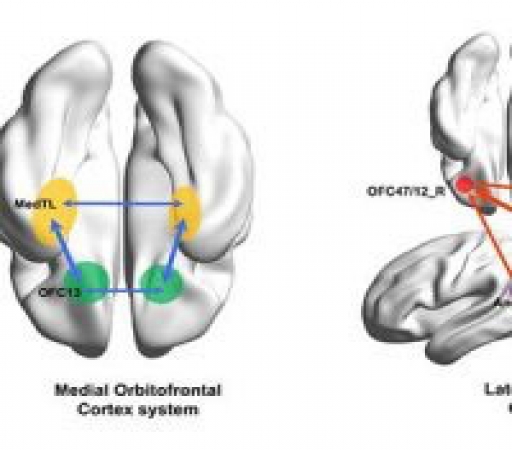 جایگاه افسردگی در مغز کشف شد