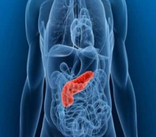 سرطان پانکراس چهارمین سرطان شایع دستگاه گوارش