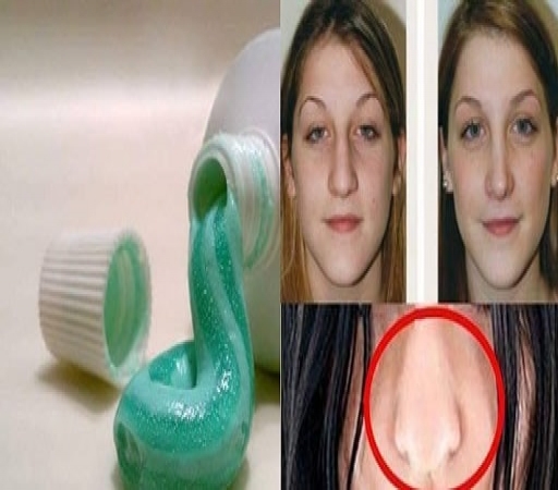 کوچک کردن و زیبایی بینی کاملا رایگان