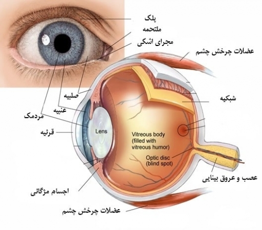 گلوکوم یا آب سیاه