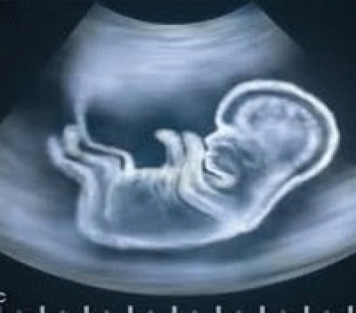 مرز اعتماد به سونوگـرافی تا کجاست؟