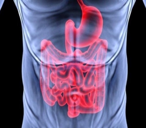 نرخ ابتلا به سرطان مقعد در دنیا افزایش یافته است