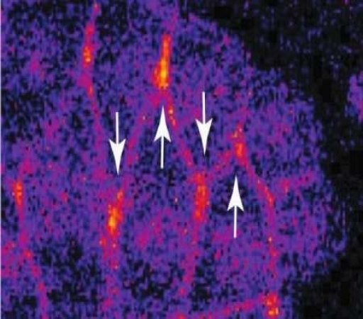 شناسایی یک پروتئین حیاتی برای رشد بافت های بدن