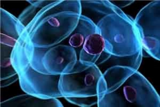 استفاده از سلول‌های بنیادی در درمان زخم دیابتی