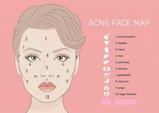 جوشهای صورت زنگ خطر ابتلا به چه بیماریهایی هستند؟