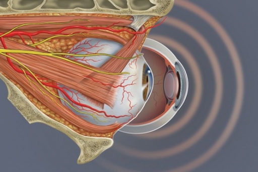 وقتی که چشم سکته می کند